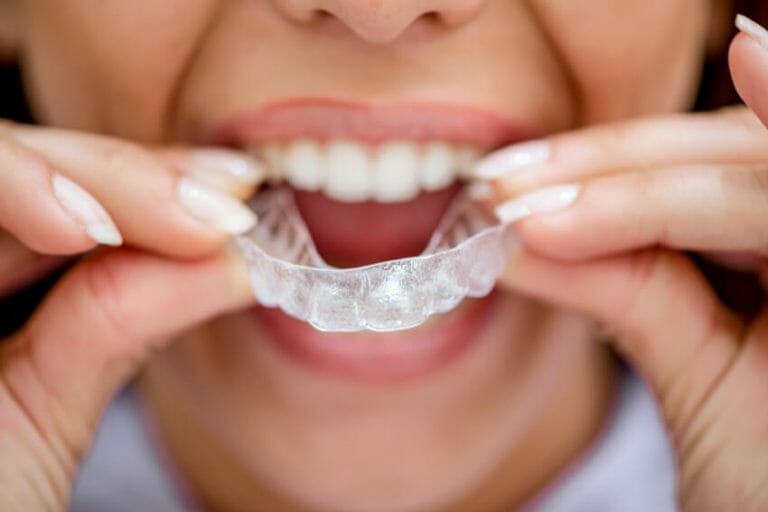 We Offer Bruxism Treatment for TMJ & Teeth Grinding