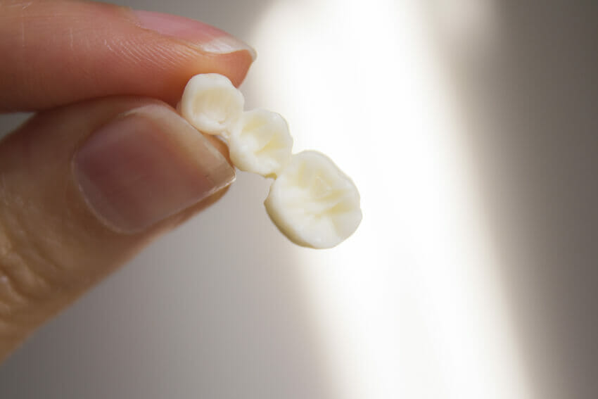 woman holding dental bridge before being inserted into dental patient's mouth