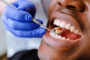 Man getting dental exam