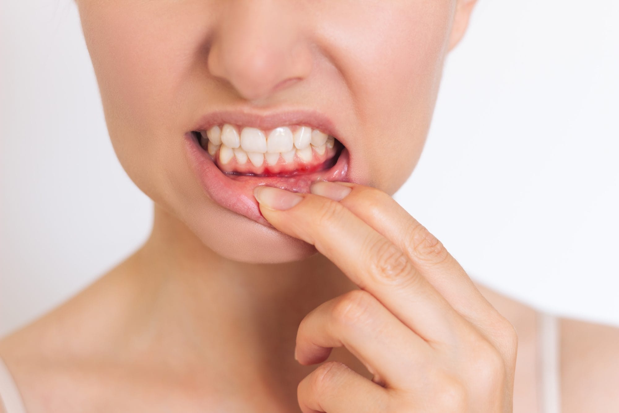 Spring Is a Wake-Up Call for Gum Disease: Early Signs You Shouldn’t Ignore